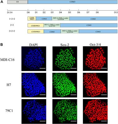 Temporal Control of the WNT Signaling Pathway During Cardiac Differentiation Impacts Upon the Maturation State of Human Pluripotent Stem Cell Derived Cardiomyocytes